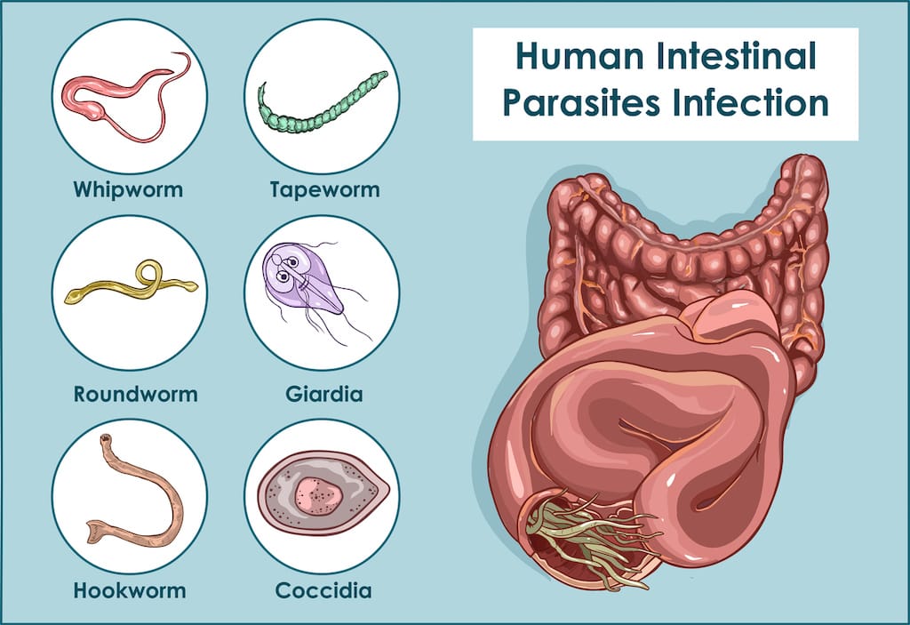 Home Parasites 1